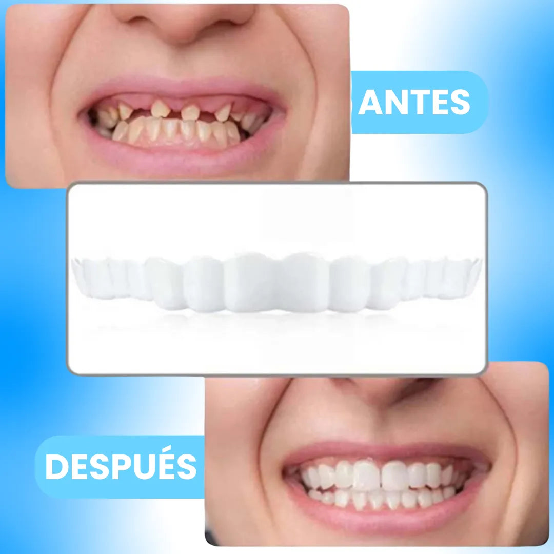 HappySmile® Carillas Dentales 😆🦷 2x1🎁